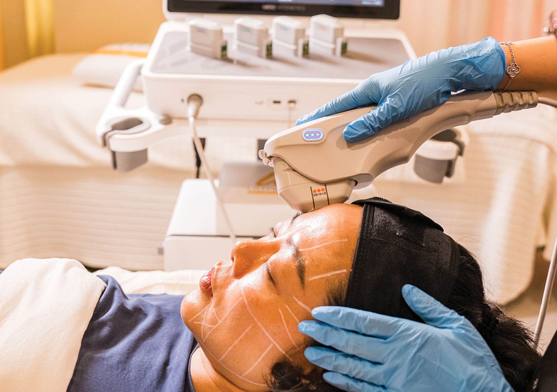 Botox Cairns